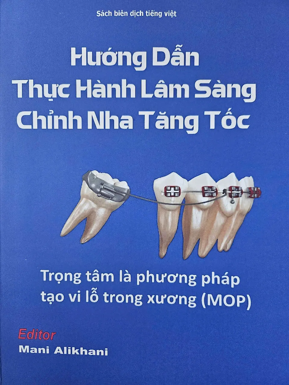 ''Hướng dẫn thực hành lâm sàng chỉnh nha tăng tốc''