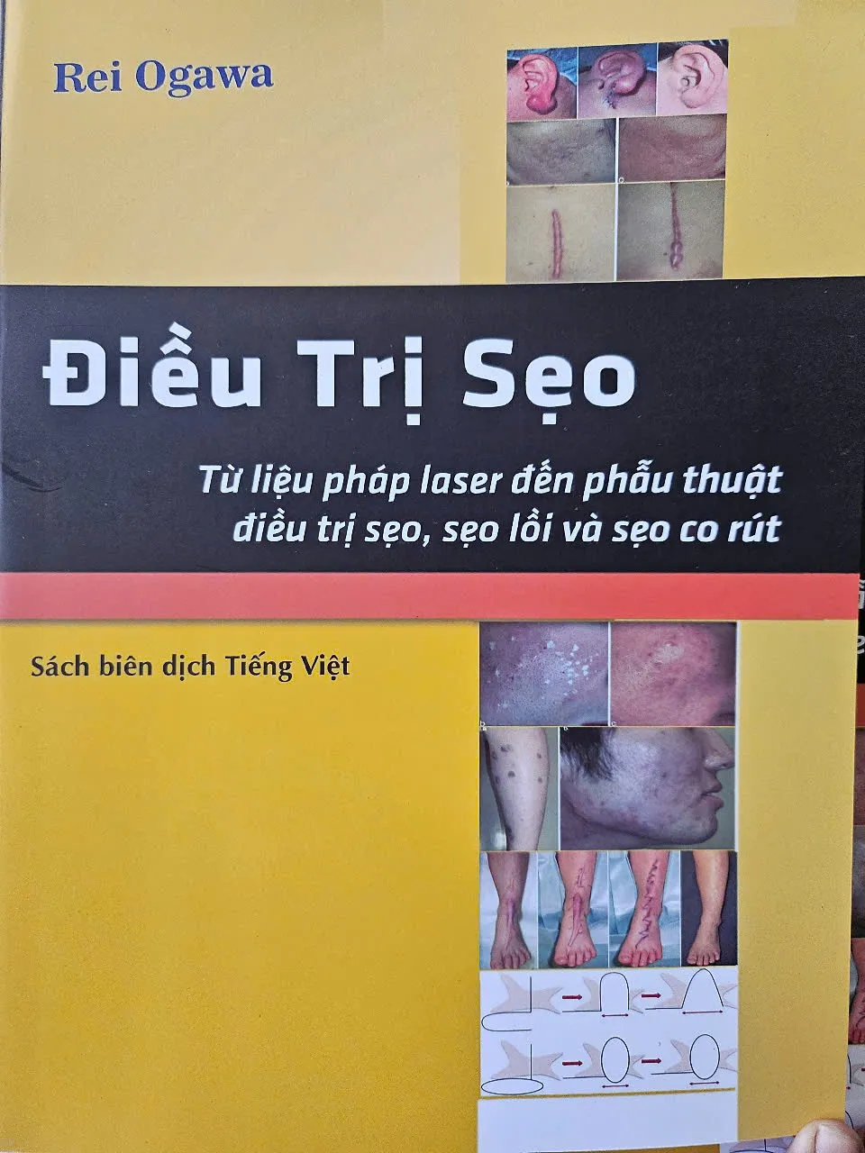 ''Tài liệu ĐIỀU TRỊ SẸO''